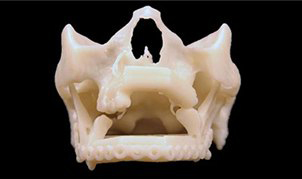 仁心仁术和3D打印技...